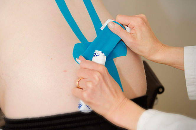 Kinesio-Tape Nahaufnahme